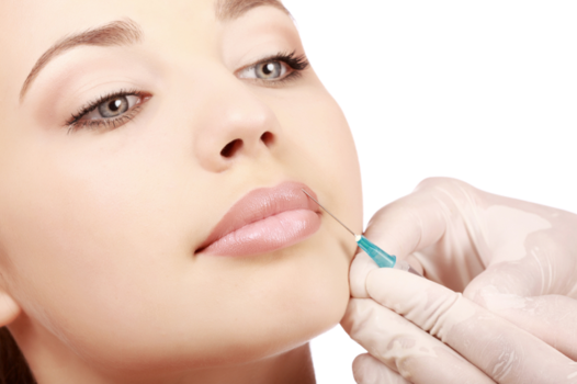 Everything You Ever Wanted To Know About Dermal Fillers